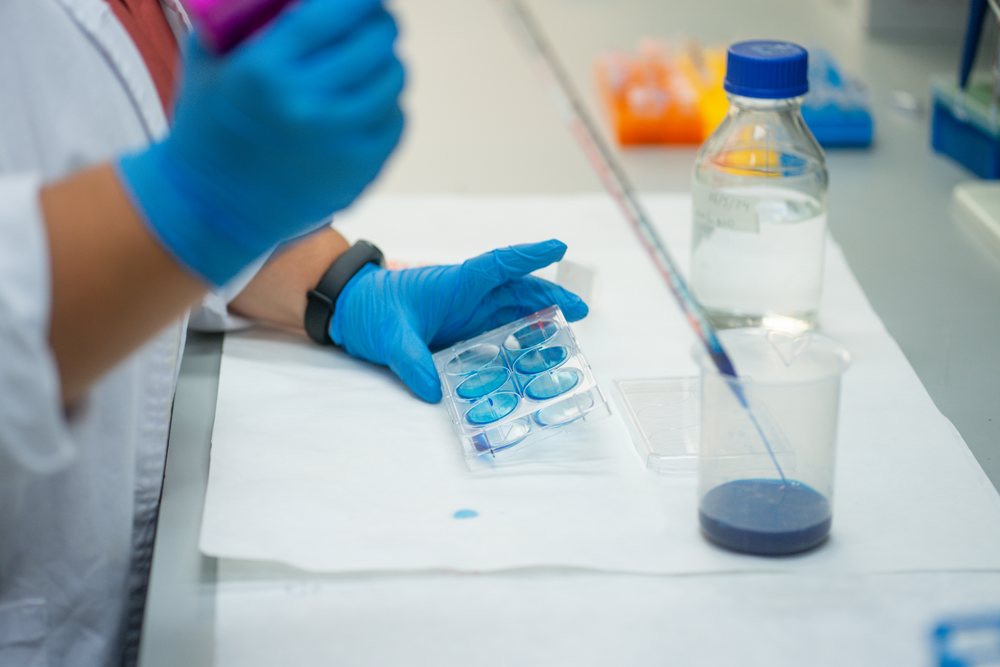 Researcher wearing blue gloves holds a plastic well plate with blue liquid during laboratory work, research, biology, Seville, Andalucía.